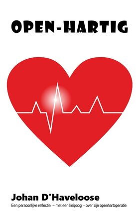 OPEN-HARTIG | Johan D'Haveloose